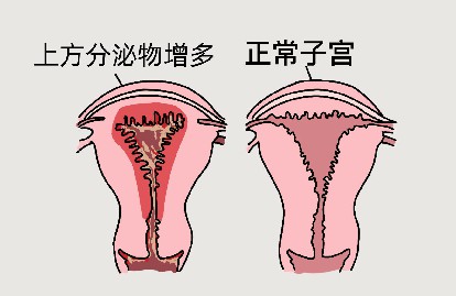 分泌物增多