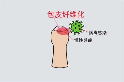 慢性炎症图
