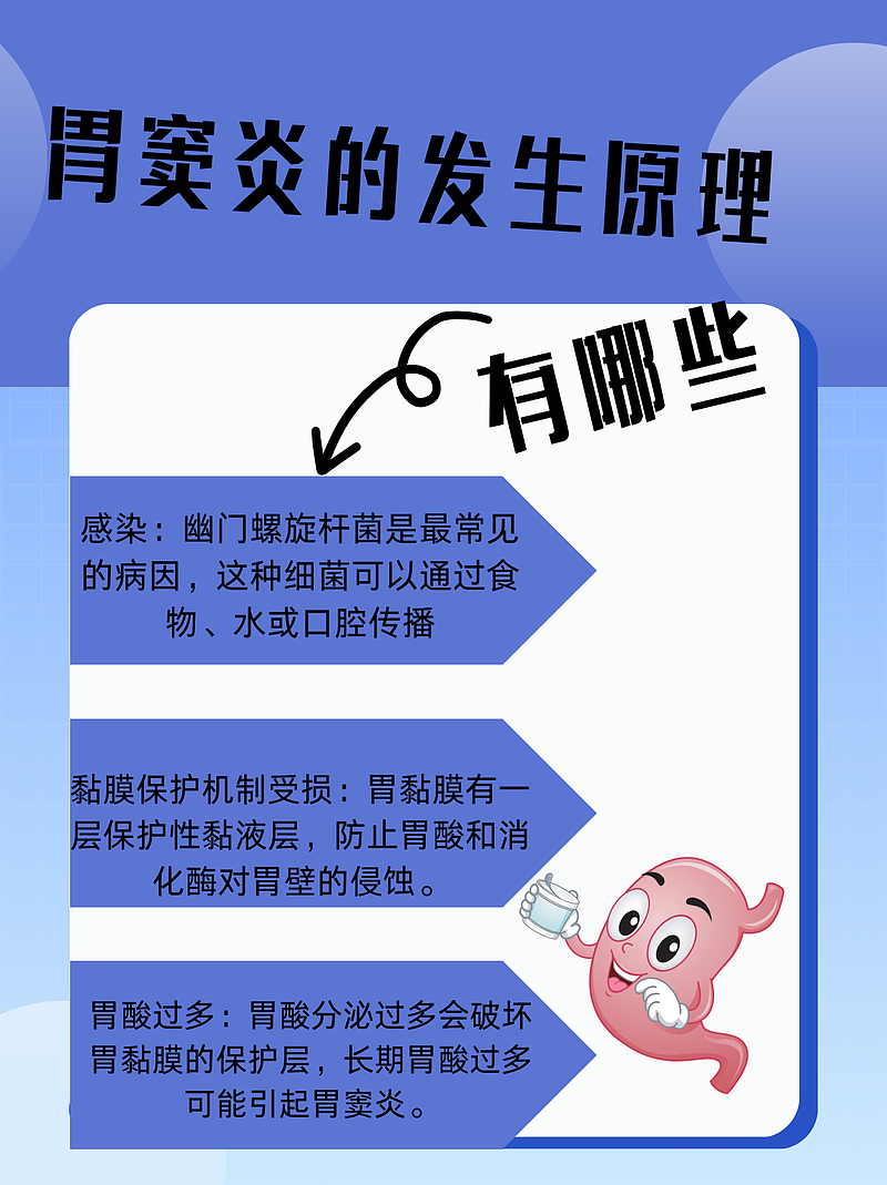 胃窦炎治疗药物推荐：高效缓解症状