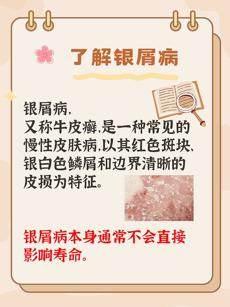 银屑病患者：皮损不代表寿命，乐享生活每一天