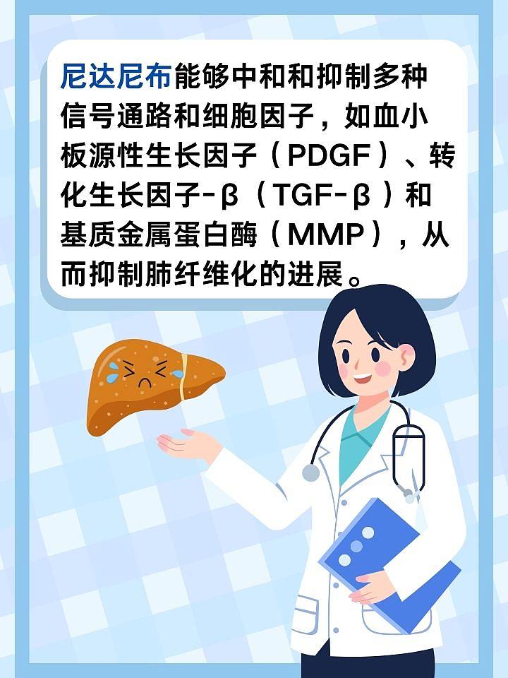 尼达尼布治疗肺纤维化