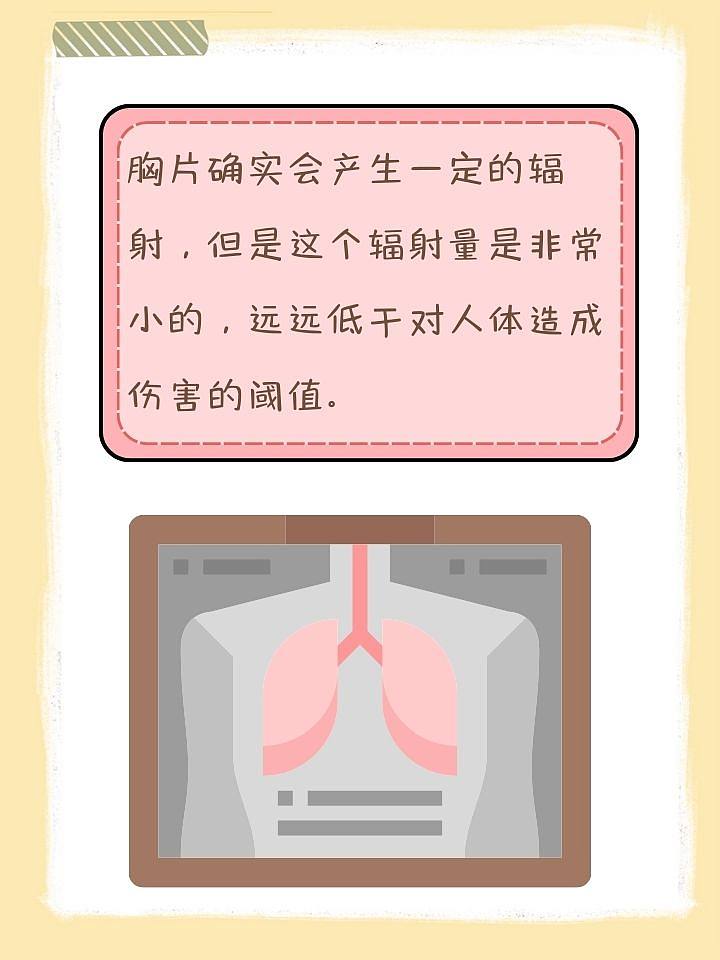 胸片有辐射吗？医生来为你揭秘！