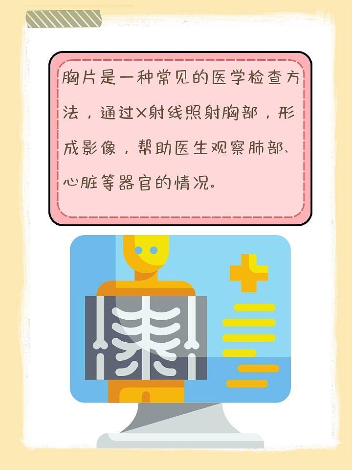 胸片有辐射吗？医生来为你揭秘！