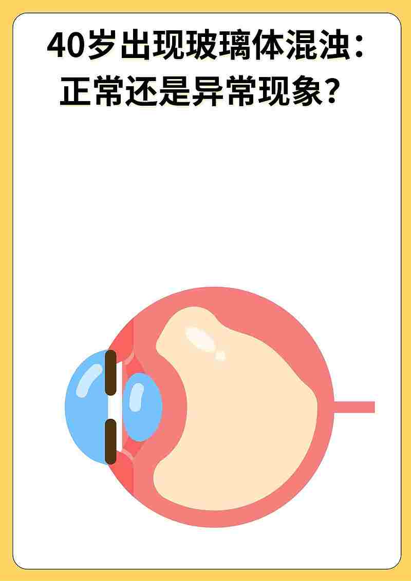 40岁出现玻璃体混浊：正常还是异常现象？