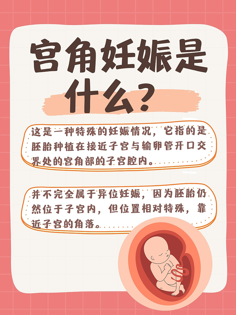 宫角妊娠：一场生命的考验与守护