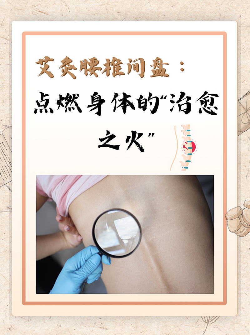 艾灸腰椎间盘：点燃身体的“治愈之火”