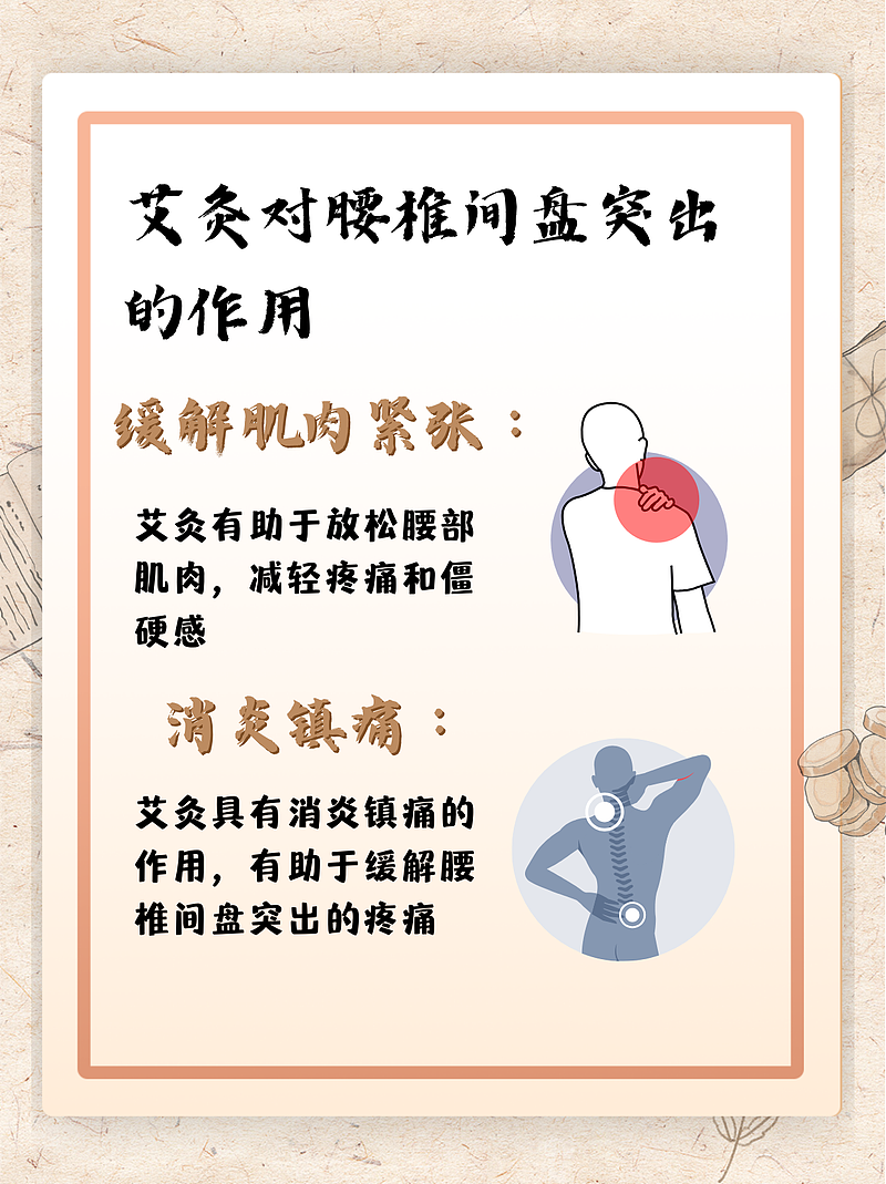 艾灸腰椎间盘：点燃身体的“治愈之火”