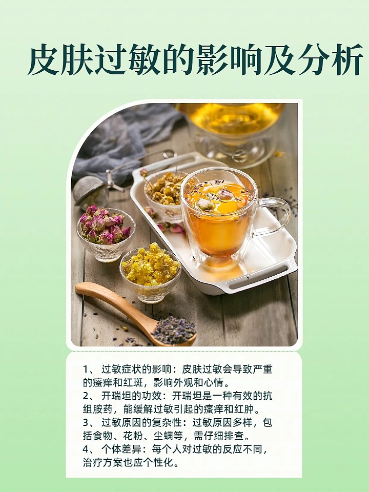 开瑞坦，能快速缓解过敏症状吗？