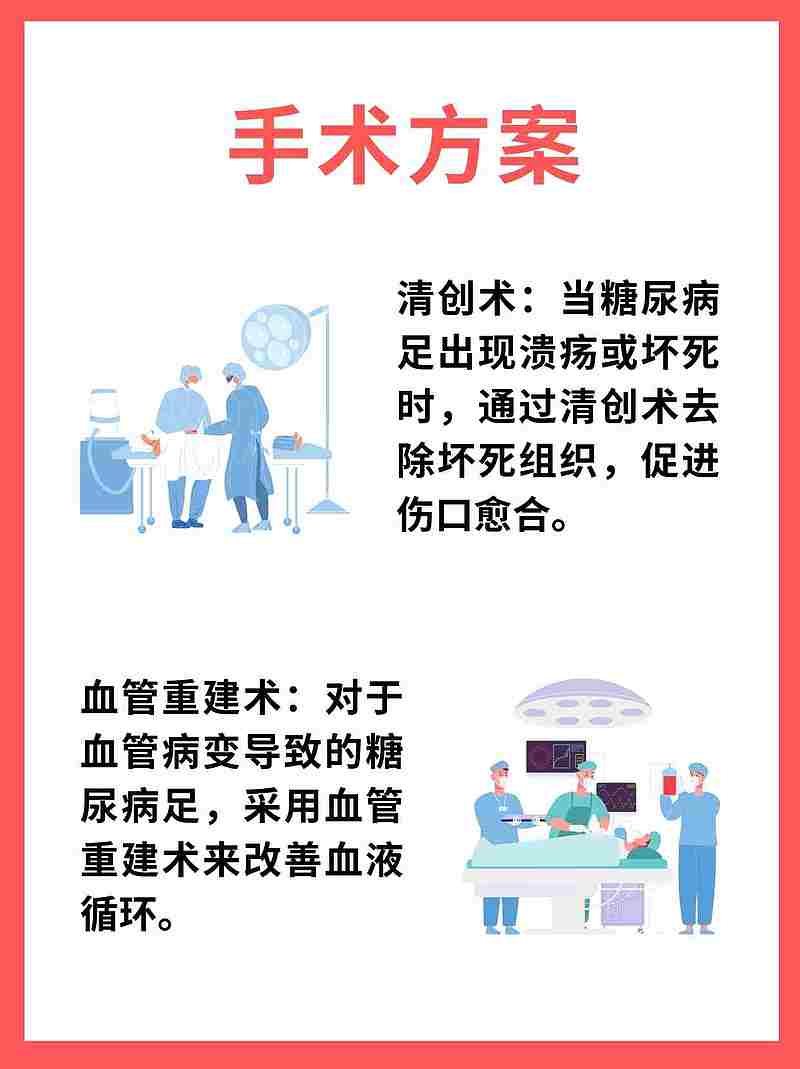 糖尿病足变黑，截肢是唯一选择吗？