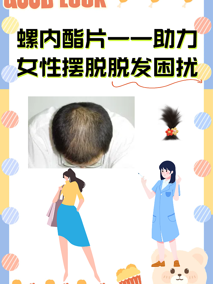 螺内酯片——助力女性摆脱脱发困扰