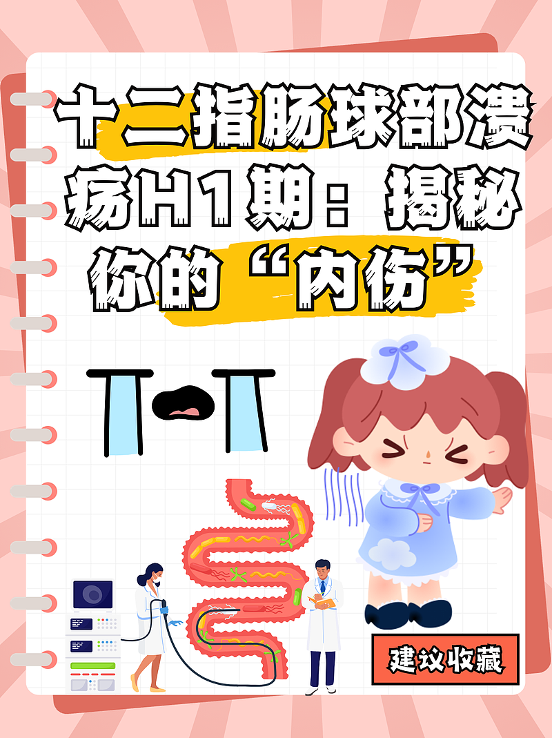 十二指肠球部溃疡H1期：揭秘你的“内伤”