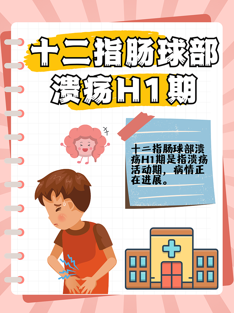 十二指肠球部溃疡H1期：揭秘你的“内伤”