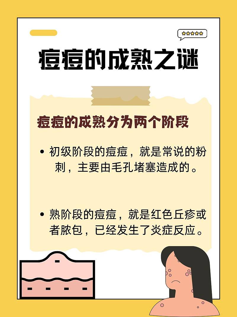 医生密授：痘痘成熟记——破解“痘”争战记