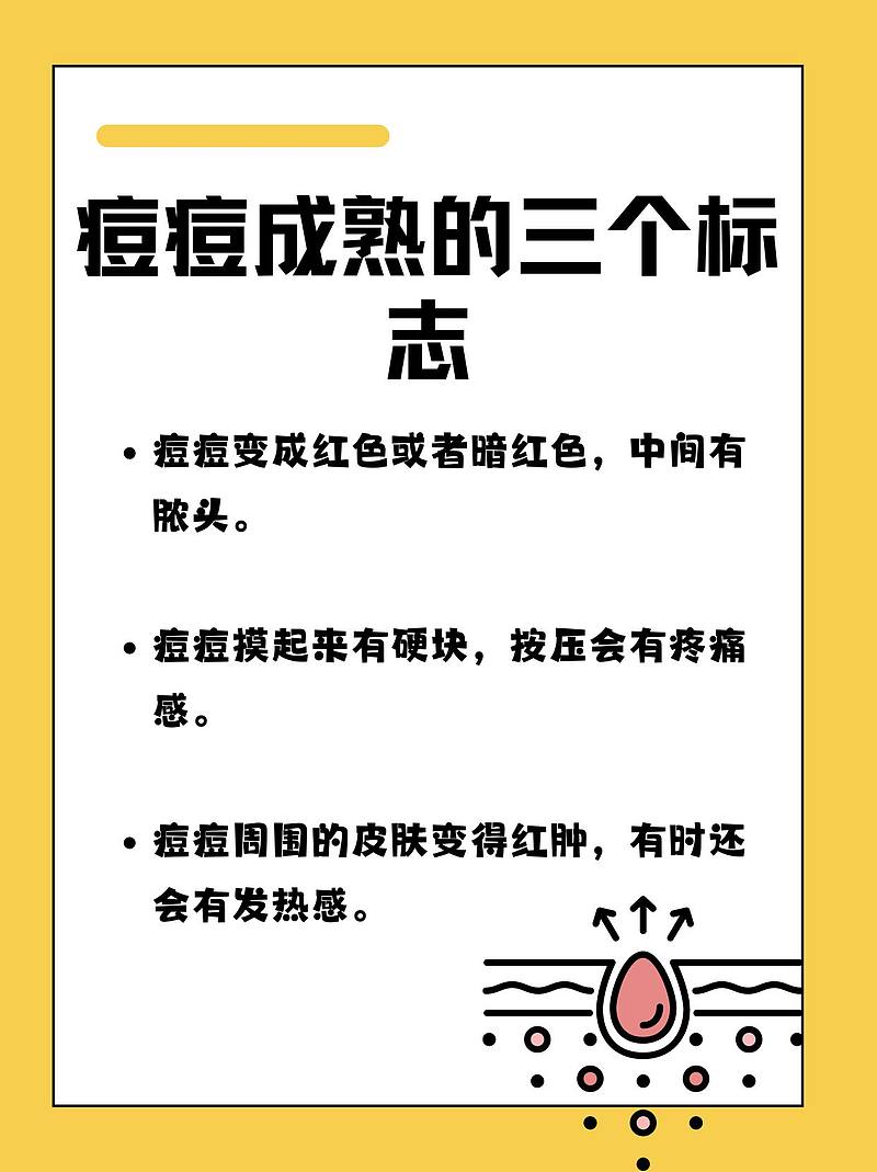 医生密授：痘痘成熟记——破解“痘”争战记