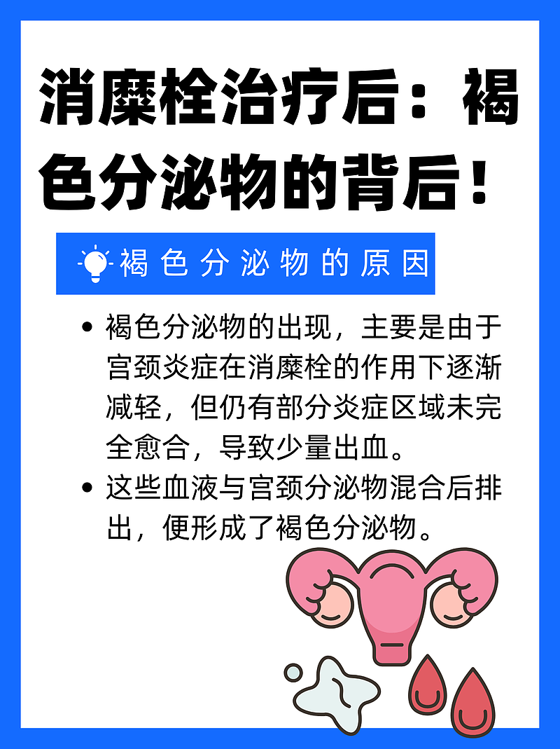 消糜栓治疗后：褐色分泌物的背后！