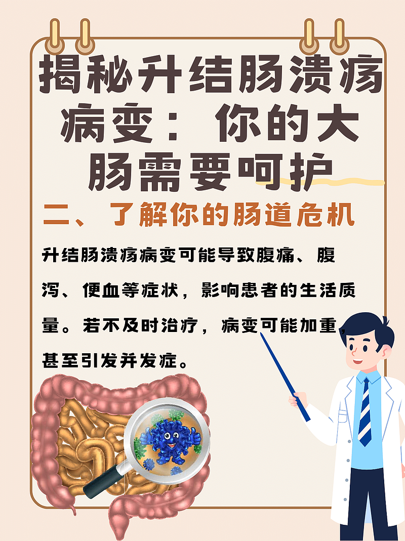 升结肠溃疡病变：我与患者的趣味诊断之旅