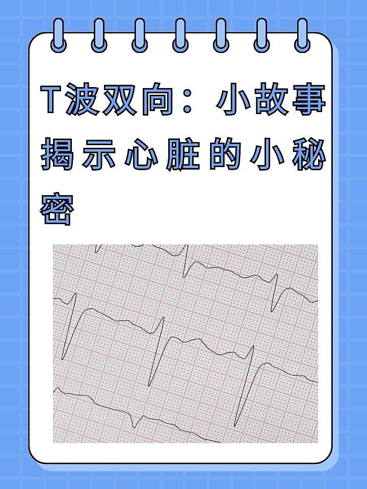 T波双向：小故事揭示心脏的小秘密