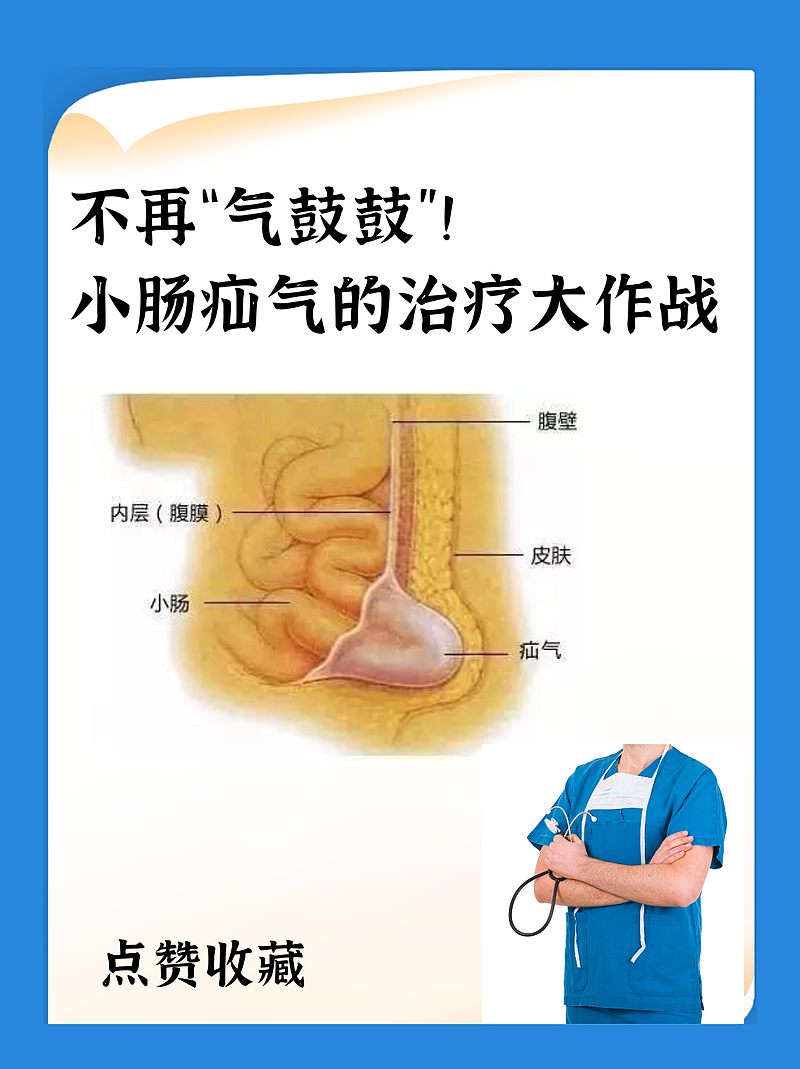 不再“气鼓鼓”！小肠疝气的治疗大作战