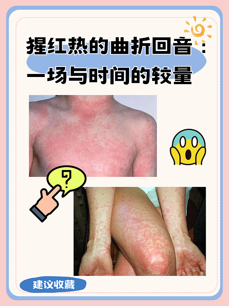 猩红热的曲折回音：一场与时间的较量
