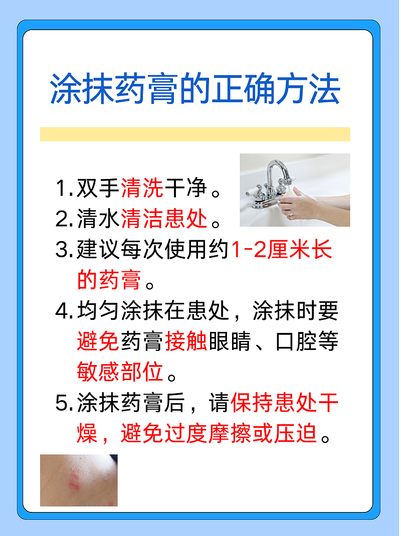皮肤救星：派瑞松药膏的特性解析
